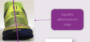 Zapatilla deformada por exceso de pronación