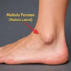 Maleolo peroneal
