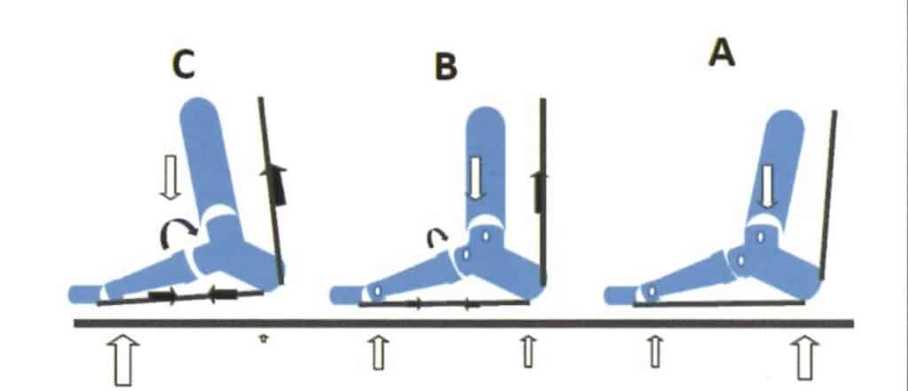 Sistema Aquíleo-calcáneo-plantar