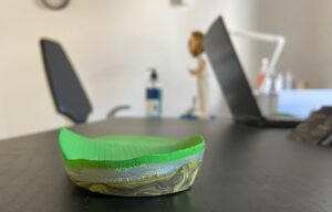 Plantilla tendinitis peroneos